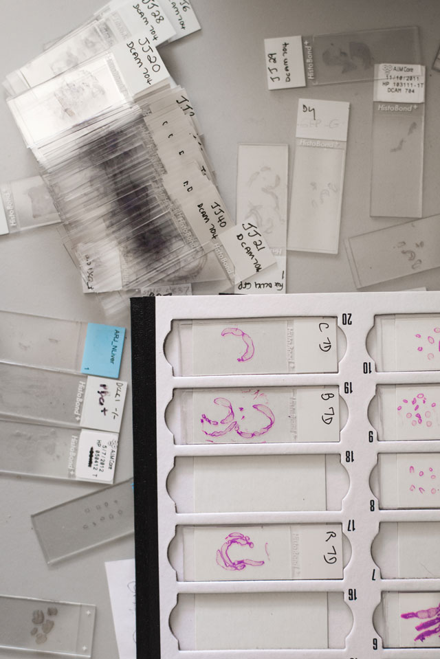 THE NCI-MATCH TRIAL ANALYZES TUMORS TO DETERMINE WHETHER THEY CONTAIN GENETIC ABNORMALITIES FOR WHICH A TARGETED DRUG EXISTS. PHOTO COURTESY STEPHENSON CANCER CENTER.